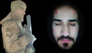 Güzellik merkezi bir gencin hayallerini yıktı