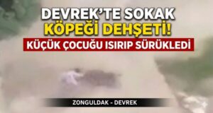 Devrek’te sokak köpeği dehşeti: Küçük çocuğu ısırıp sürükledi