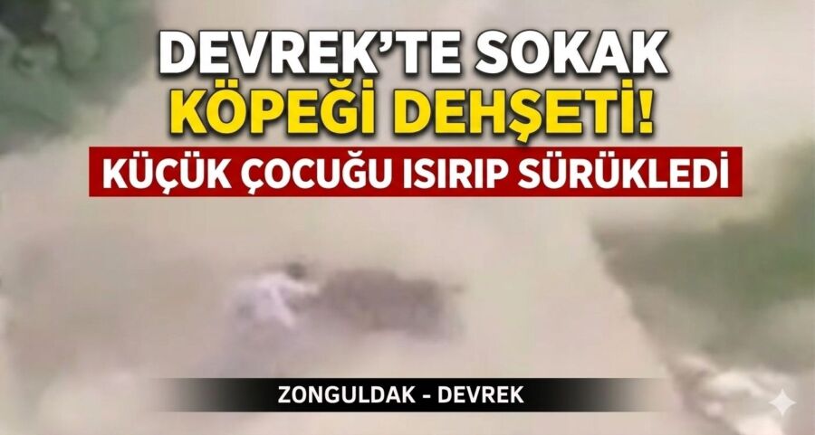 Devrek’te sokak köpeği dehşeti: Küçük çocuğu ısırıp sürükledi