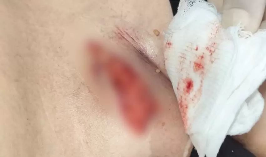 Echomar Hastanesi’nde skandal iddia